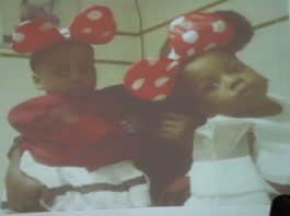 Separated conjoined twins.